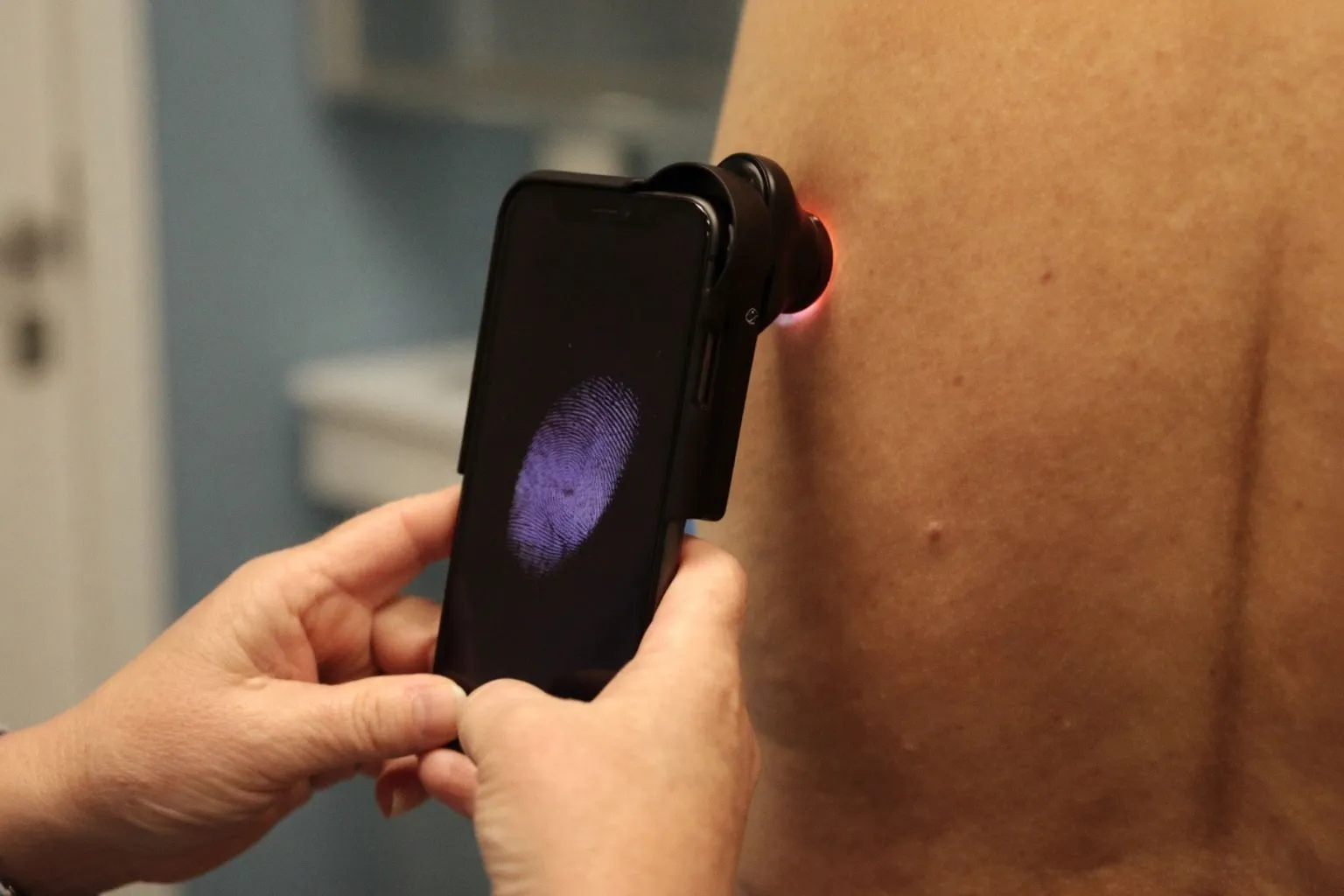 Sztuczna inteligencja w diagnostyce onkologicznej: jak systemy AI wspierają ocenę zmian skórnych